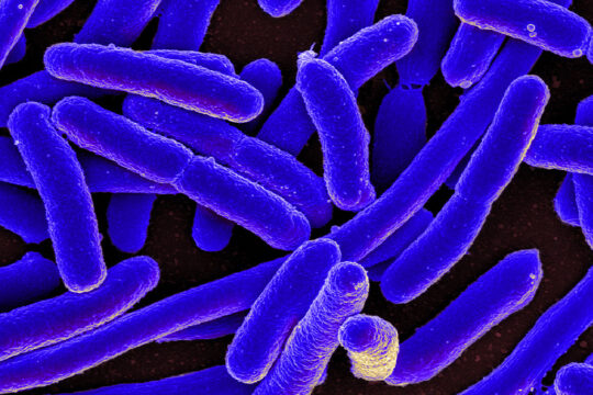Colorized scanning electron micrograph of Escherichia coli, grown in culture and adhered to cover slip.
